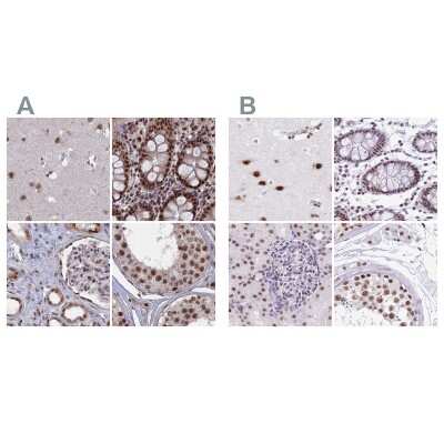 Immunohistochemistry-Paraffin: SF3A2 Antibody [NBP2-48775]