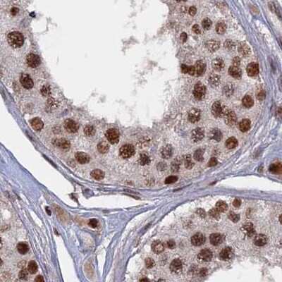Immunohistochemistry-Paraffin: SF3A2 Antibody [NBP2-48775]