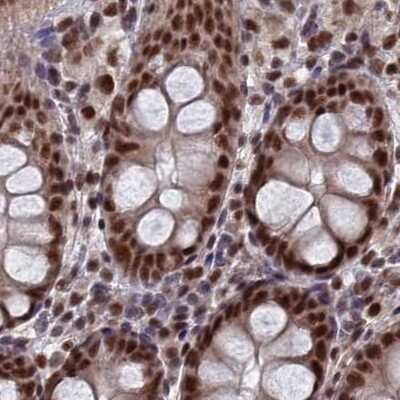 Immunohistochemistry-Paraffin: SF3A2 Antibody [NBP2-48775]