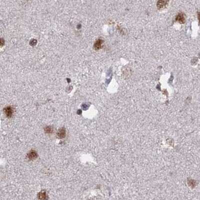 Immunohistochemistry-Paraffin: SF3A2 Antibody [NBP2-48775]