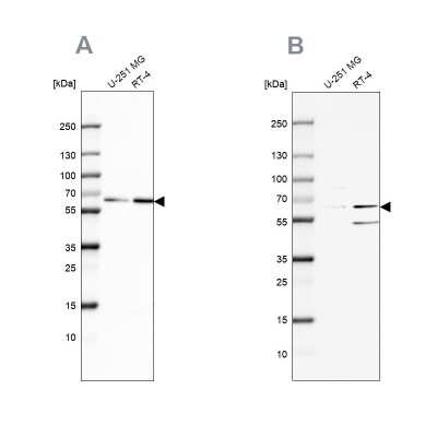 Western Blot: SF3A2 Antibody [NBP2-47281]