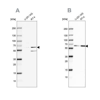 Western Blot: SF3A2 Antibody [NBP2-48775]