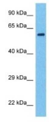 Western Blot: SF3A2 Antibody [NBP3-09943]