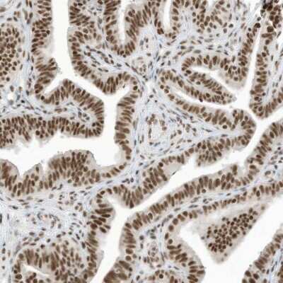 Immunohistochemistry-Paraffin: SF3A3 Antibody [NBP1-87212]