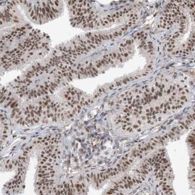 Immunohistochemistry-Paraffin: SF3A3 Antibody [NBP2-38200]