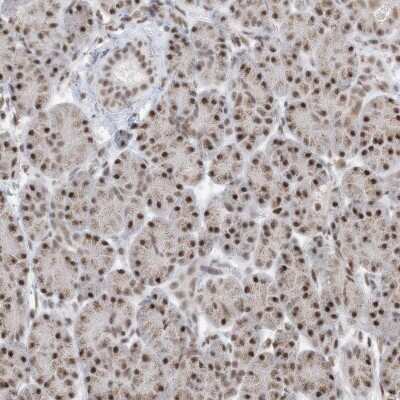Immunohistochemistry-Paraffin: SF3A3 Antibody [NBP2-38200]