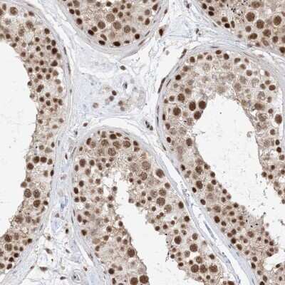 Immunohistochemistry-Paraffin: SF3A3 Antibody [NBP2-38200]