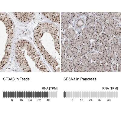 Immunohistochemistry-Paraffin: SF3A3 Antibody [NBP2-38200]