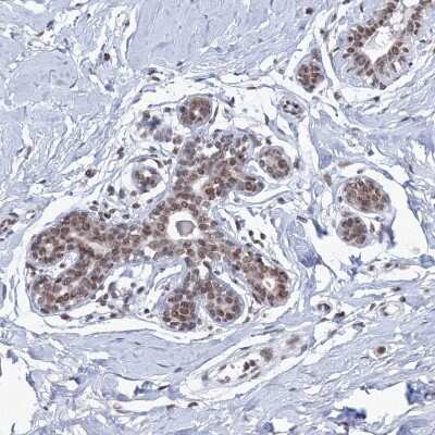 Immunohistochemistry-Paraffin: SF3B14 Antibody [NBP1-87430]