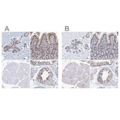 Immunohistochemistry-Paraffin: SF3B14 Antibody [NBP1-87430]