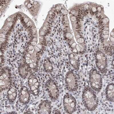 Immunohistochemistry-Paraffin: SF3B14 Antibody [NBP1-87430]