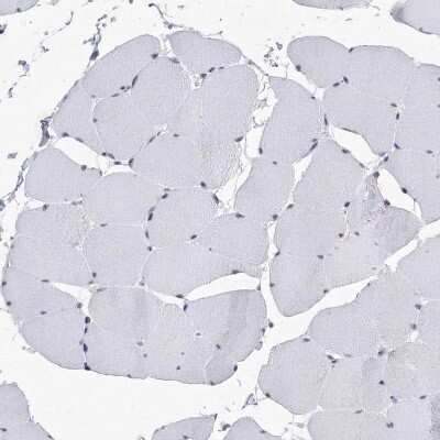 Immunohistochemistry-Paraffin: SF3B14 Antibody [NBP1-87430]