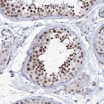 Immunohistochemistry-Paraffin: SF3B14 Antibody [NBP1-87430]