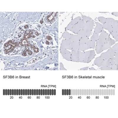 Immunohistochemistry-Paraffin: SF3B14 Antibody [NBP1-87430]