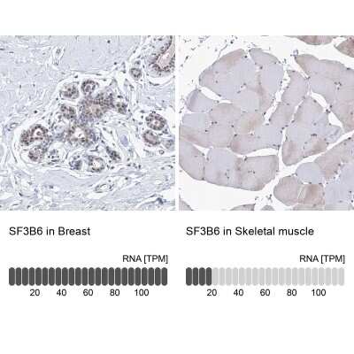 Immunohistochemistry-Paraffin: SF3B14 Antibody [NBP1-87431]