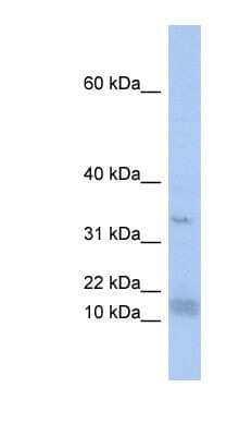 Western Blot: SF3B14 Antibody [NBP1-57226]