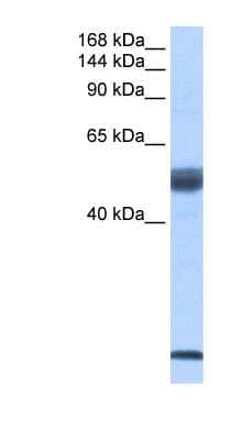 Western Blot: SF3B14 Antibody [NBP1-57227]