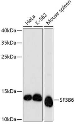 Western Blot: SF3B14 AntibodyAzide and BSA Free [NBP2-94304]