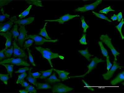 Immunocytochemistry/ Immunofluorescence: SF3B2 Antibody (2A2) [H00010992-M10]