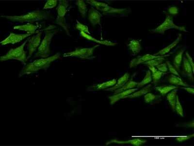 Immunocytochemistry/ Immunofluorescence: SF3B2 Antibody (2A2) [H00010992-M10]