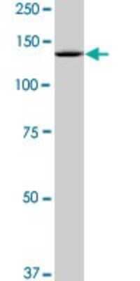 Western Blot: SF3B2 Antibody (2A2) [H00010992-M10]