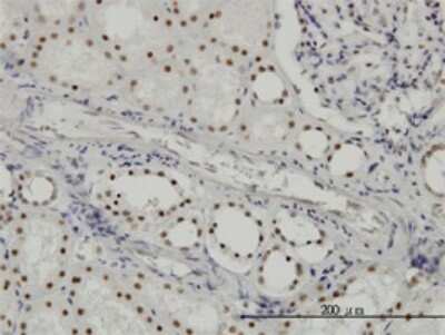 Immunohistochemistry-Paraffin: SF3B2 Antibody (5D2) [H00010992-M01]