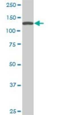 Western Blot: SF3B2 Antibody (5D2) [H00010992-M01]