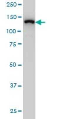 Western Blot: SF3B2 Antibody (5D2) [H00010992-M01]