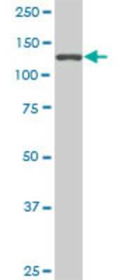 Western Blot: SF3B2 Antibody (5D2) [H00010992-M01]