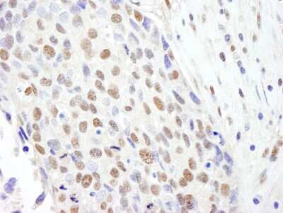 Immunohistochemistry: SF3B2 Antibody [NB100-79847]
