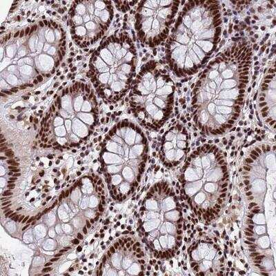 Immunohistochemistry-Paraffin: SF3B2 Antibody [NBP1-92380]