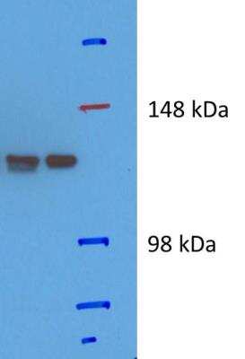 Western Blot: SF3B2 Antibody [NB100-79847]