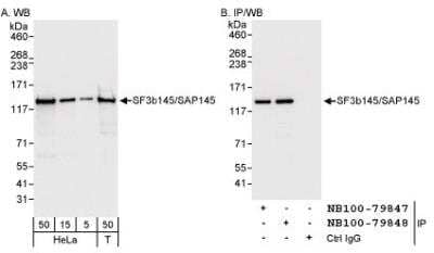 Western Blot: SF3B2 Antibody [NB100-79848]