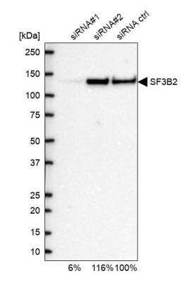 Western Blot: SF3B2 Antibody [NBP1-92380]