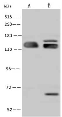 Western Blot: SF3B2 Antibody [NBP2-97657]