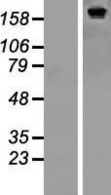 Western Blot: SF3B2 Overexpression Lysate [NBP2-07573]