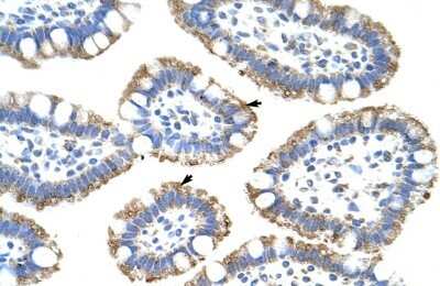 Immunohistochemistry-Paraffin: SF3B4 Antibody [NBP1-57419]