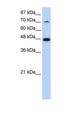 Western Blot: SF3B4 Antibody [NBP1-57419]