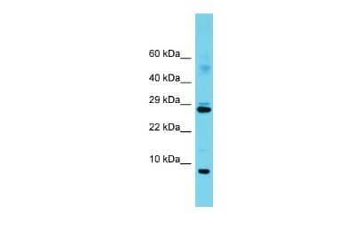 Western Blot: SF3B5 Antibody [NBP2-85711]