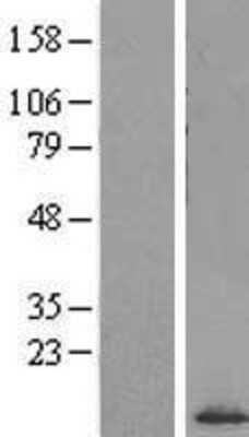 Western Blot: SF3B5 Overexpression Lysate [NBL1-15879]