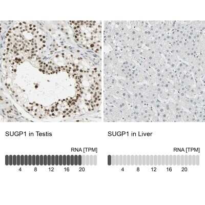 Immunohistochemistry-Paraffin: SF4 Antibody [NBP1-88000]