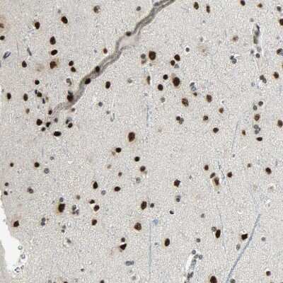 Immunohistochemistry-Paraffin: SF4 Antibody [NBP1-88000]