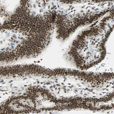 Immunohistochemistry-Paraffin: SF4 Antibody [NBP1-88000]