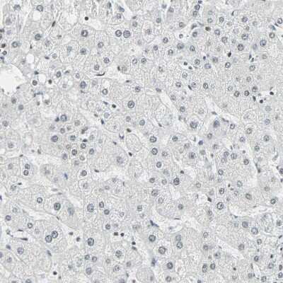 Immunohistochemistry-Paraffin: SF4 Antibody [NBP1-88000]