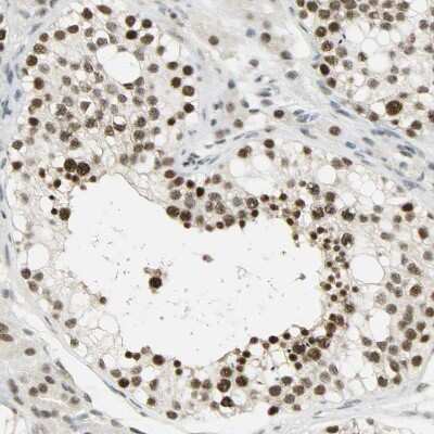 Immunohistochemistry-Paraffin: SF4 Antibody [NBP1-88000]