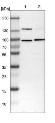 Western Blot: SF4 Antibody [NBP1-88000]