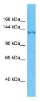 Western Blot: SFI1 Antibody [NBP3-09931]