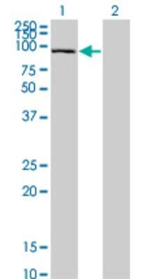 Western Blot: SFMBT1 Antibody (2A1) [H00051460-M02]