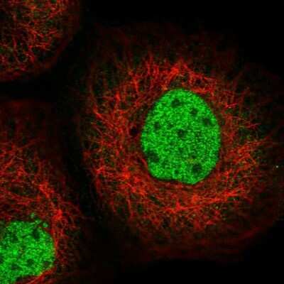 Immunocytochemistry/ Immunofluorescence: SFMBT1 Antibody [NBP2-48652]