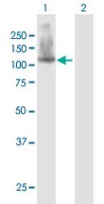 Western Blot: SFMBT1 Antibody [H00051460-B01P]